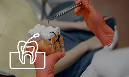 Belodent_Endodoncia_2